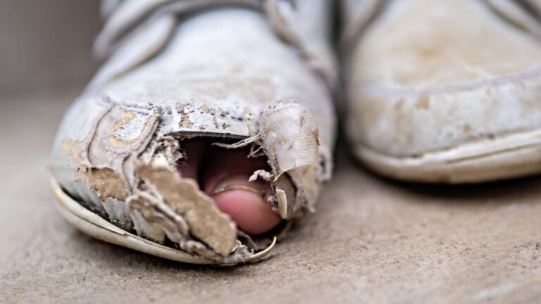 Zeh-schaut-aus-kaputtem-Sportschuh.jpg