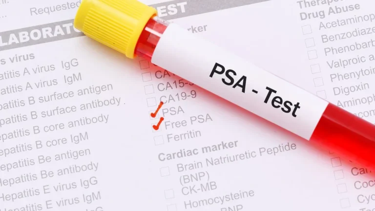 psa-test-er-soll-helfen-prostatakrebs-zu-entdecken-bevor-er-beschwerden-verursacht-doch-das-verfahre.webp