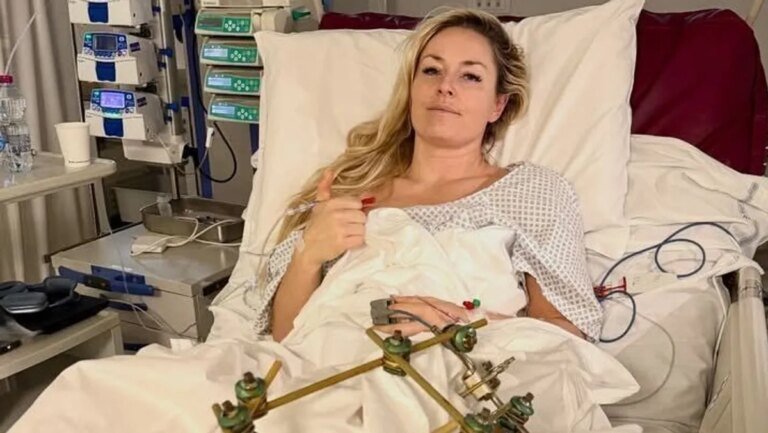 us-athletin-lindsey-vonn-sie-postet-ein-von-von-sich-aus-dem-ca-foncello-krankenhaus-in-treviso.jpg