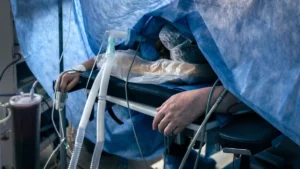 ein-nicht-identifizierter-patient-der-unter-vollnarkose-steht-liegt-auf-dem-operationstisch-in-einem.webp