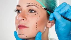 schoenheitschirurg-zeichnet-markierungen-im-gesicht-einer-patientin-eingriffe-die-das-aussehen-verbe.webp
