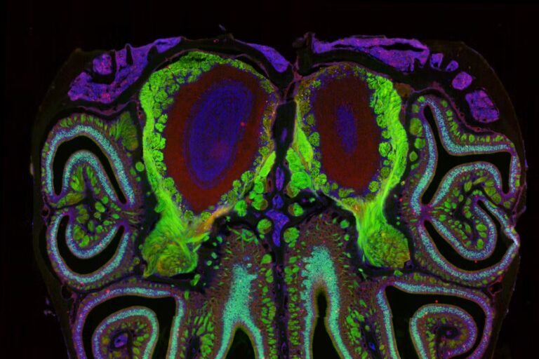 826f110_upload-1-mpiayr7igmp3-mouse-nose-2-datta-lab.jpg
