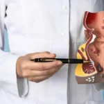 haemorrhoiden-gehoeren-zu-den-haeufigsten-analerkrankungen-jeder-mensch-besitzt-die-am-after-liegend.webp