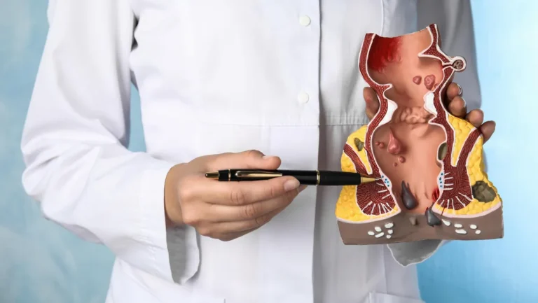 haemorrhoiden-gehoeren-zu-den-haeufigsten-analerkrankungen-jeder-mensch-besitzt-die-am-after-liegend.webp